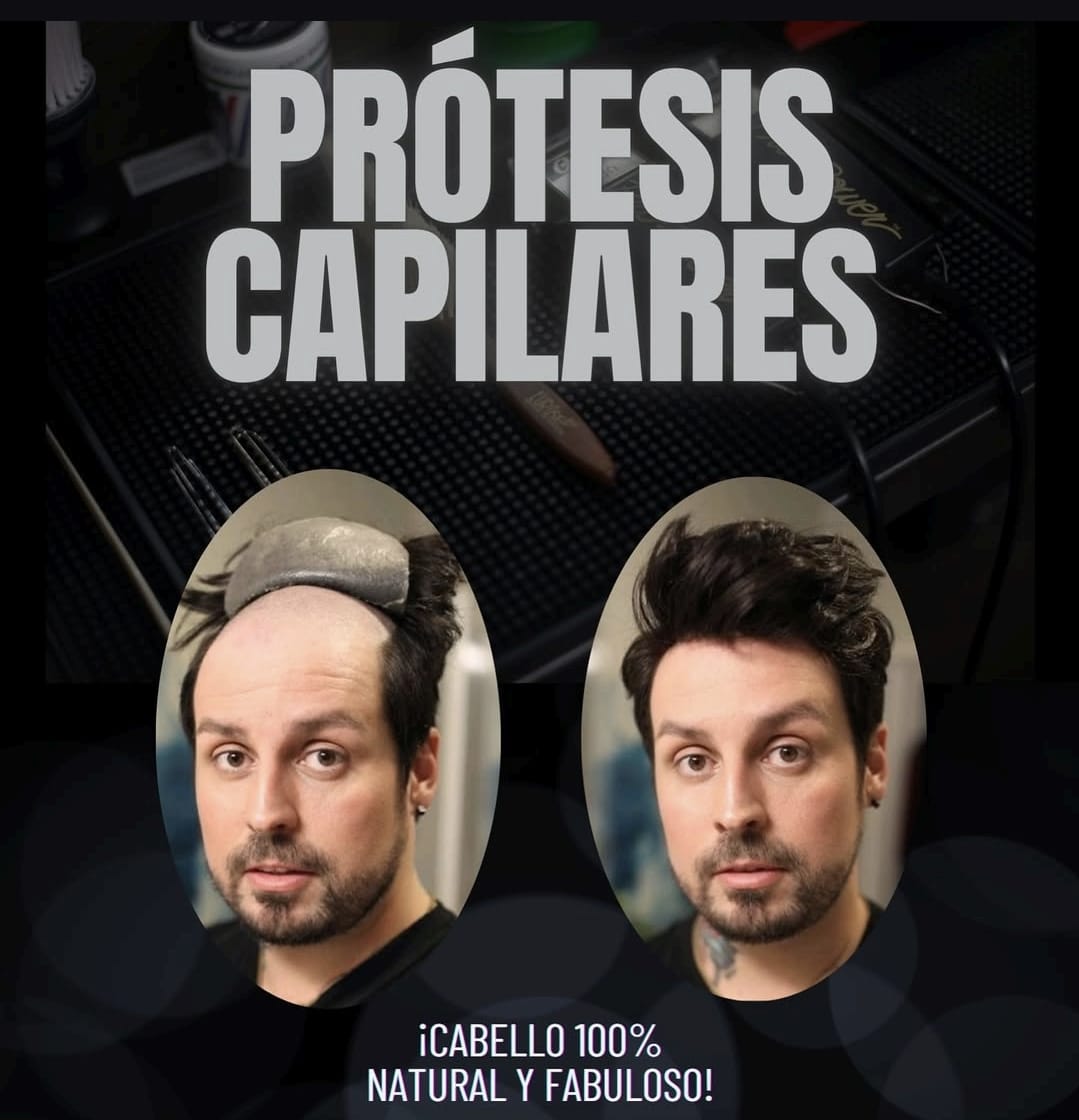 Sistemas Capilares Estilo Alfa